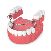 Dentiste à Paris 19 eme, 75019, Dr Giorno Hassan Elsie, Prothése amovible partielle, Dentier, Dentiste